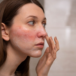 How Your Lifestyle Affects Your Sensitive Skin