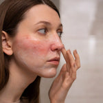 How Your Lifestyle Affects Your Sensitive Skin