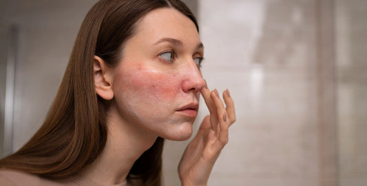 How Your Lifestyle Affects Your Sensitive Skin